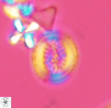 Retecapsa surirella 4240
