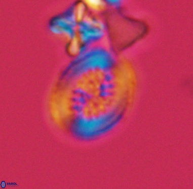 Retecapsa surirella 4241