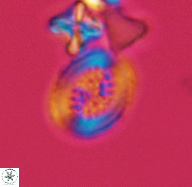 Retecapsa surirella 4241