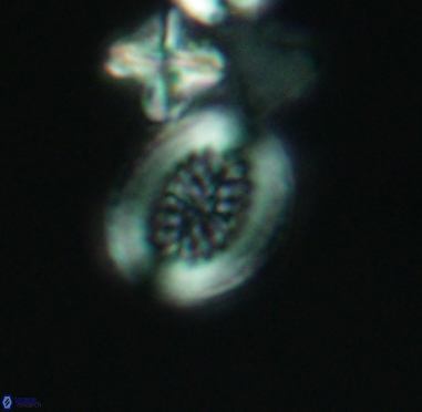 Retecapsa surirella 4242