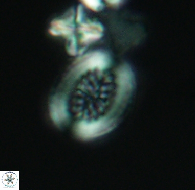 Retecapsa surirella 4242