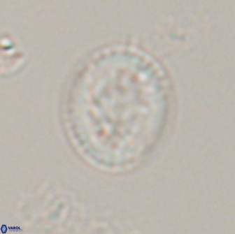 Retecapsa pentalateralis 16666