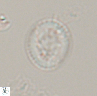 Retecapsa pentalateralis 16666