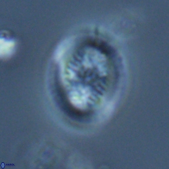 Retecapsa pentalateralis 16667