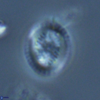 Retecapsa pentalateralis 16668