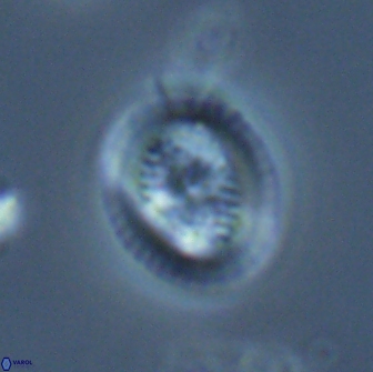 Retecapsa pentalateralis 16669