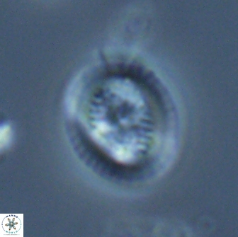 Retecapsa pentalateralis 16669