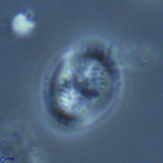 Retecapsa pentalateralis 16670