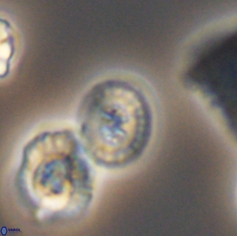 Retecapsa primitiva 8712