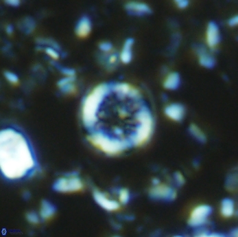 Retecapsa rotunda 6305