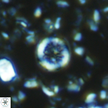 Retecapsa rotunda 6305