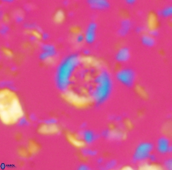 Retecapsa rotunda 6306