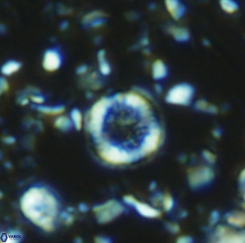 Retecapsa rotunda 6307