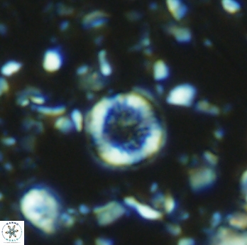 Retecapsa rotunda 6307