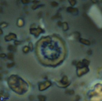 Retecapsa rotunda 6310