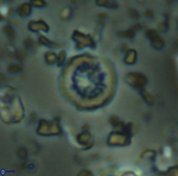 Retecapsa rotunda 6311