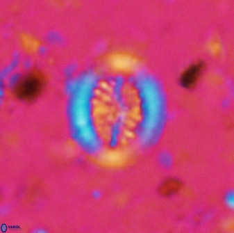 Retecapsa tetralateralis 37646