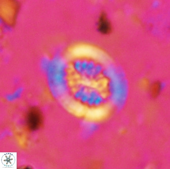 Retecapsa tetralateralis 37648
