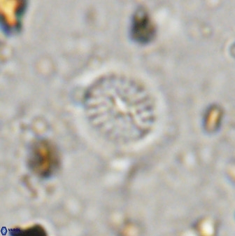 Retecapsa tetralateralis 37649