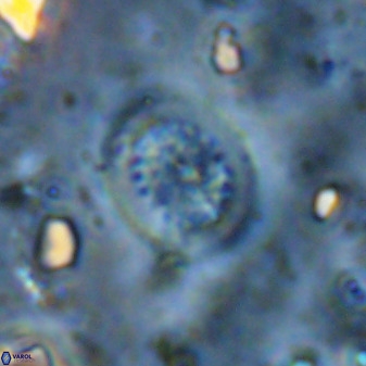 Retecapsa tetralateralis 37650