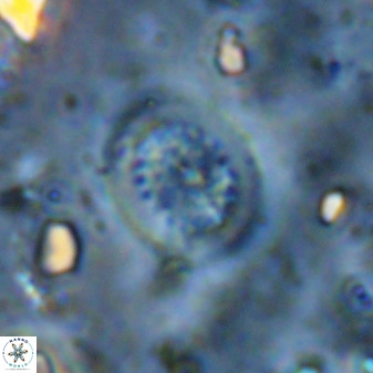 Retecapsa tetralateralis 37650
