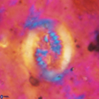 Retecapsa tetralateralis 6186