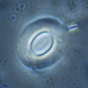 Reticulofenestra ampla 29891