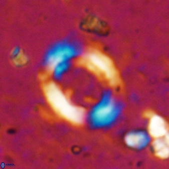 Reticulofenestra ampliumbilicus 19534