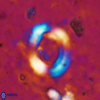 Reticulofenestra ampliumbilicus 19536