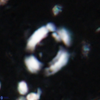 Reticulofenestra ampliumbilicus 19538