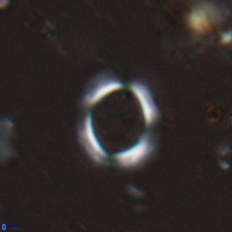 Reticulofenestra ampliumbilicus 27557