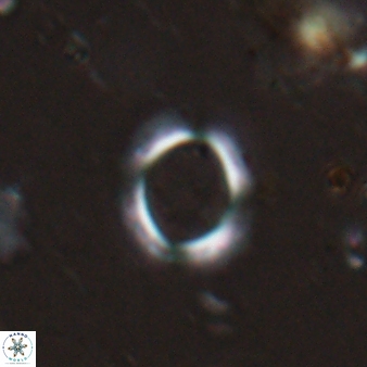 Reticulofenestra ampliumbilicus 27557