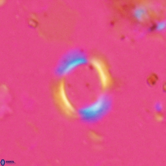 Reticulofenestra ampliumbilicus 27558