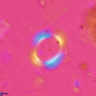 Reticulofenestra ampliumbilicus 27559