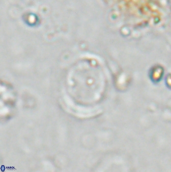 Reticulofenestra ampliumbilicus 27561