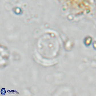 Reticulofenestra ampliumbilicus 27561