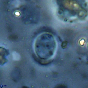 Reticulofenestra ampliumbilicus 27562