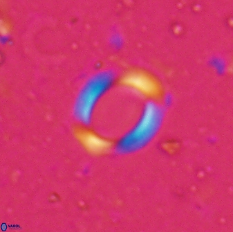 Reticulofenestra ampliumbilicus 29855