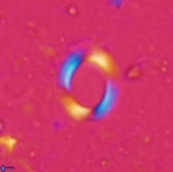 Reticulofenestra ampliumbilicus 29857