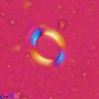 Reticulofenestra ampliumbilicus 29859