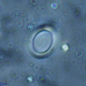 Reticulofenestra ampliumbilicus 29862