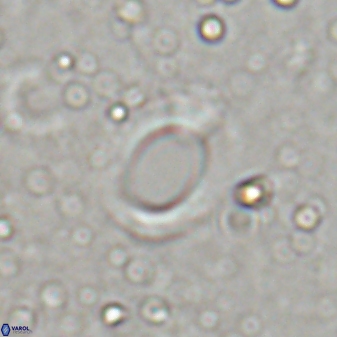 Reticulofenestra ampliumbilicus 29863