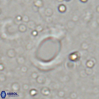 Reticulofenestra ampliumbilicus 29863