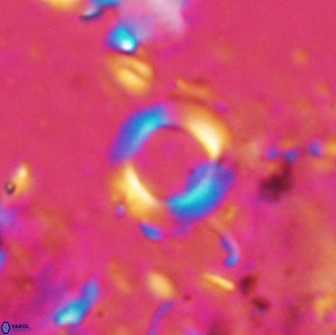 Reticulofenestra bukryi 14954