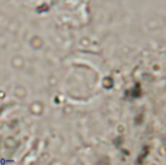 Reticulofenestra bukryi 14955