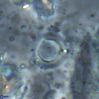 Reticulofenestra bukryi 14956