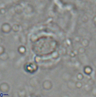 Reticulofenestra bukryi 26484