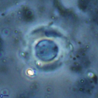 Reticulofenestra bukryi 26485