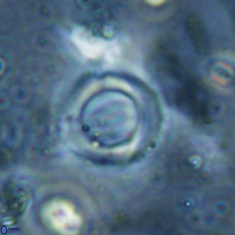 Reticulofenestra bukryi 26523