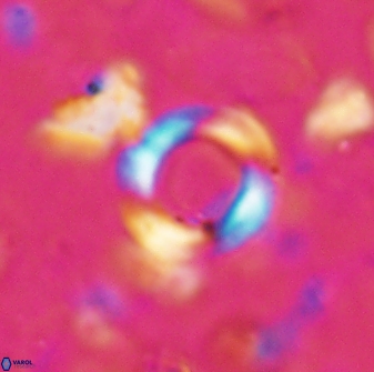 Reticulofenestra bukryi 26527